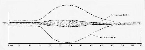 M80 ball wound (18k jpg)