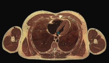 human torso x-section (45k jpg)